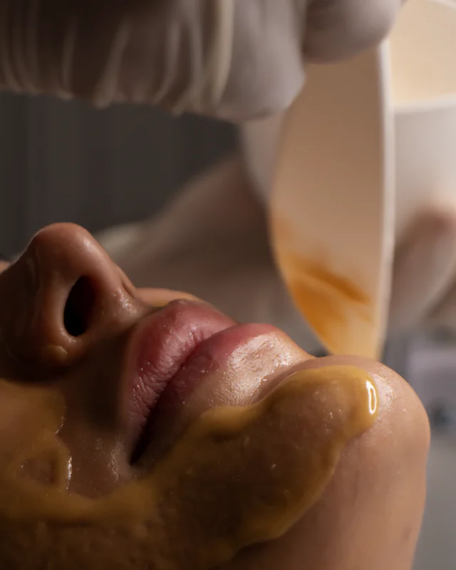 A gloved hand applying an amber gel mask to the chin from a small bowl